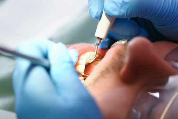 Best Emergency Treatment for Toothache in Fern Acres, HI